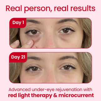 AuraOne Red Light + Microcurrent Eye Glasses